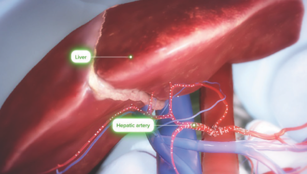 Liver-Directed AAV Delivery Preview